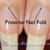 See Through Nails - Image of Eponychium and Proximal Fold.001