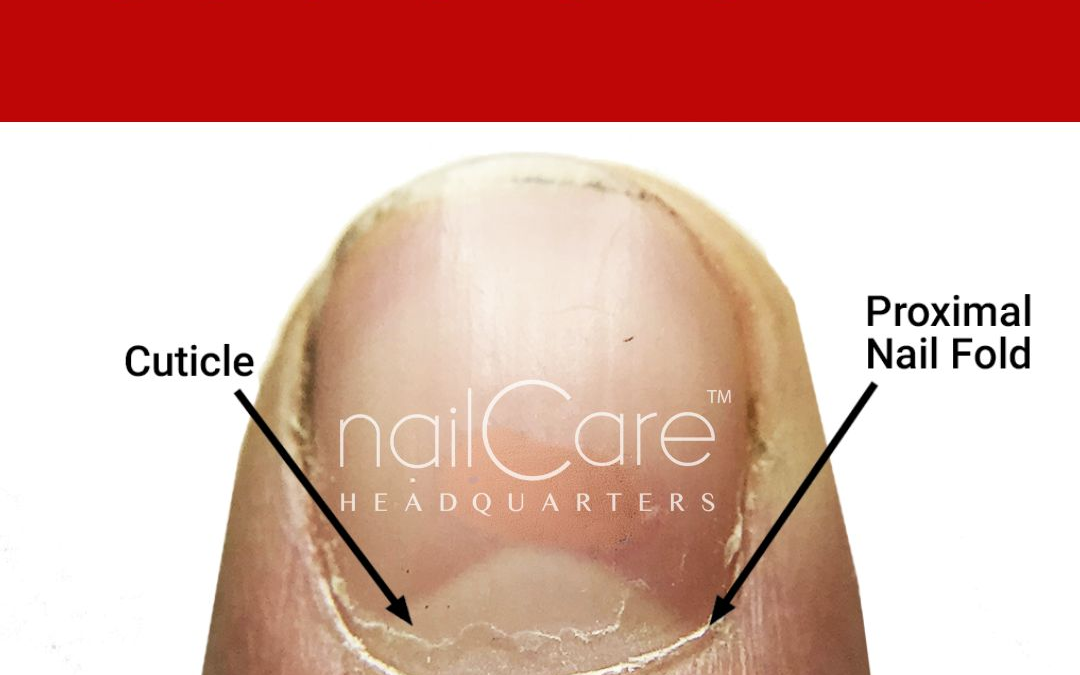 The Cuticle – Should You Clip, Push, or Scrape?